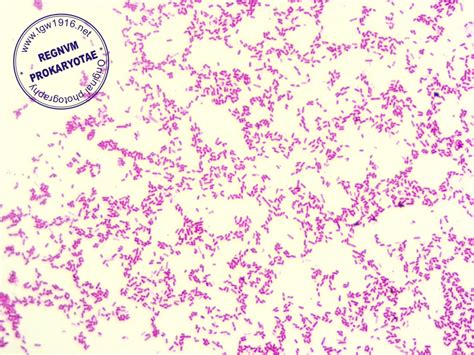 Pseudomonas Aeruginosa Gram Stain