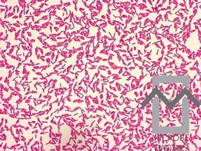 Pseudomonas Aeruginosa Gram Stain