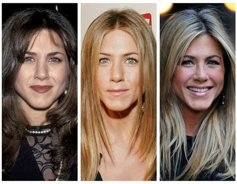 Jennifer Aniston's Plastic Surgery: See Her Nose Job Before and After ...