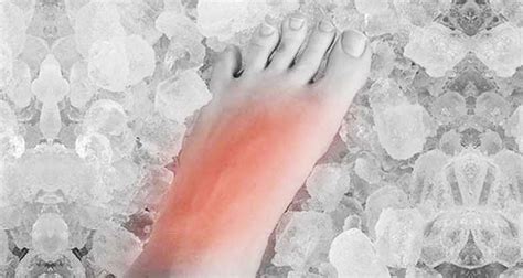 Pain On Top Of The Foot - Injuries, Causes, Treatment & Exercises