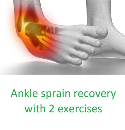 Sprained ankle cause, symptoms, and treatment with exercises