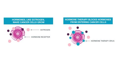 Breast cancer study tests pairing hormone therapy with immunotherapy ...