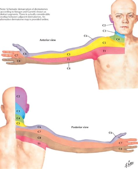 Dermatome distribution for the cervical spine - Netter | Medical ...