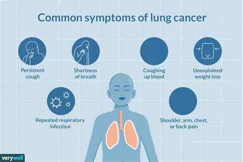 Lung Cancer in Young Adults - MEDizzy