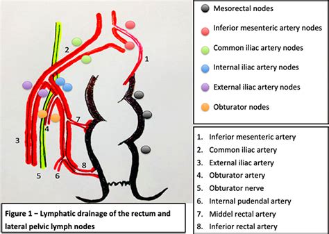 Presacral Lymph Nodes