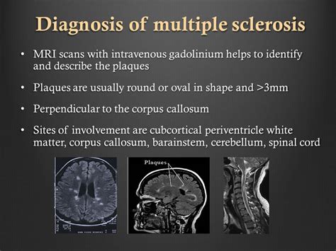 Multiple sclerosis skin lesions: Understanding Multiple Sclerosis (MS ...