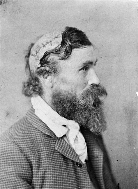 Robert McGee, the man who was scalped as a child by Native American ...