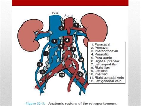 Retroperitoneal Lymph Node Dissection