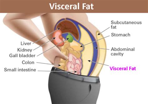 Visceral Fat- Causes, Risks and Ways to Reduce Visceral Fat