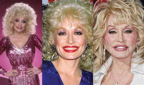 Dolly Parton Plastic Surgery Before and After 2017 | Dolly parton ...