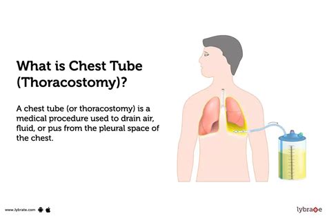 Chest Tube (Thoracostomy): Causes, Symptoms, Treatment and Cost