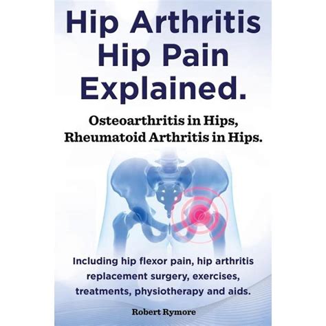 Hip Arthritis, Hip Pain Explained. Osteoarthritis in Hips, Rheumatoid ...