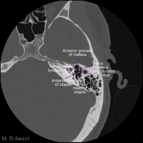 Mastoid Ear Anatomy : Anatomy Of The Ear / | Img Shirely