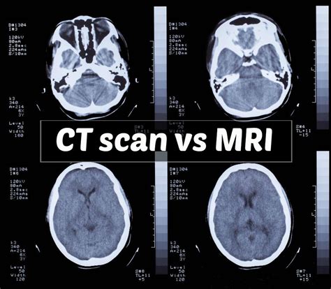 CT vs. MRI: Understanding the Differences - Kings Medical Group