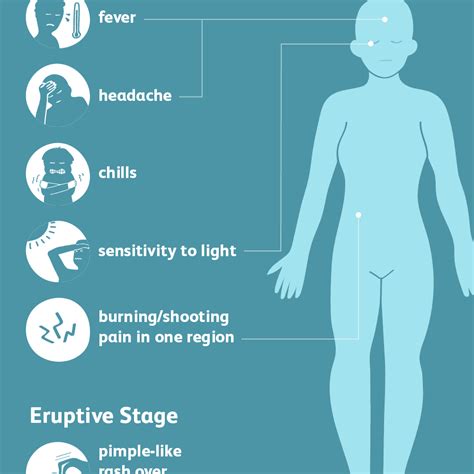 Shingles Symptoms