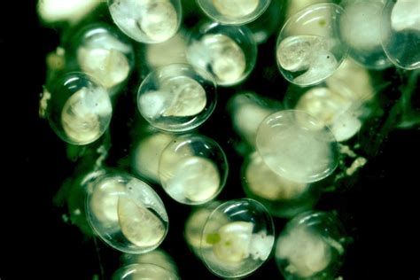 Physid snail embryos. | Smithsonian Photo Contest | Smithsonian Magazine