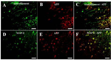 Double-immunofluorescence staining of localized neurofilaments (A) or ...