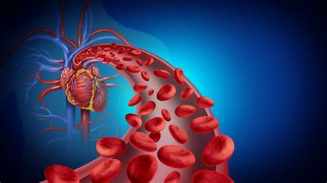 The Crucial Difference Between Hypovolemic and Hemorrhagic Shock - CVRTI