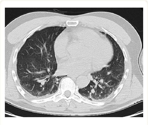 Example of a postoperative computed tomography scan. | Download ...