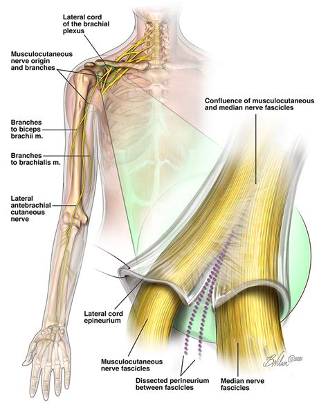 AAHS - Surgical Anatomy of the Proximal Musculocutaneous Nerve and ...