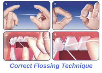 Flossing Your Teeth – Oceansight Dental & Implants