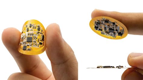 New Wireless Smart Bandage Accelerates Chronic Wound Healing | Extremetech