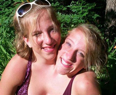 Media dis&dat: Abby and Brittany Hensel, conjoined 22-year-old twins ...