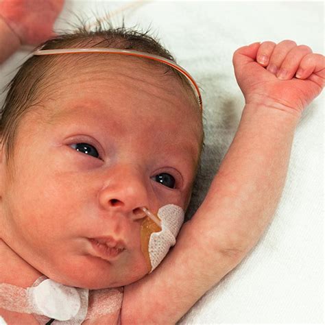 Your Preemie's Growth & Developmental Milestones - HealthyChildren.org