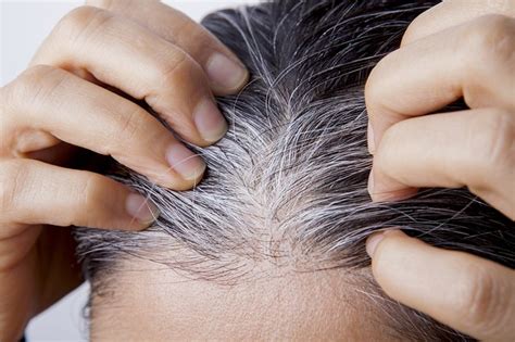 What Causes White Hair at a Young Age? | livestrong