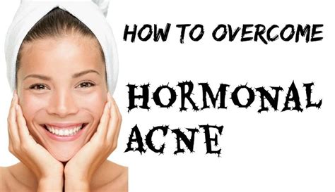 Hormonal Acne Causes. How To Treat and Get Rid of Hormonal Acne