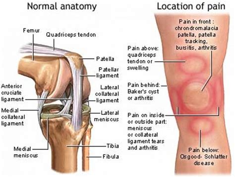 Knee Conditions: Knee Pain Causes & Treatments | Elite Podiatry