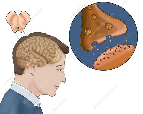 Dopamine & Parkinson's, Illustration - Stock Image - C036/5456 ...