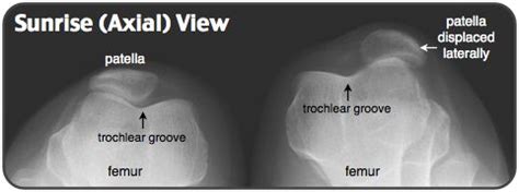 Rosh Review | Medical information, Radiology, Medical