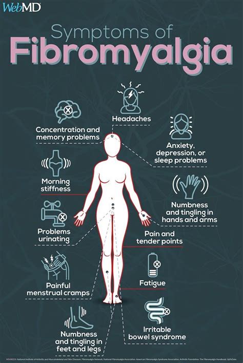 Signs Of Fibromyalgia, Fibromyalgia Pain Relief, Fibromyalgia Syndrome ...