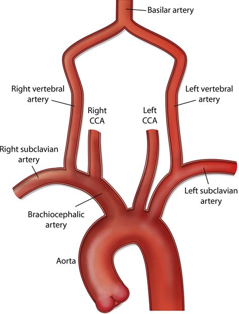 Pathophysiology Arteries Anatomy Carotid Artery Vertebral Artery ...