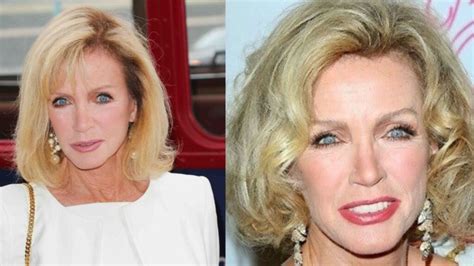 Donna Mills' Plastic Surgery Speculations 2022: Botox, Rhinoplasty ...