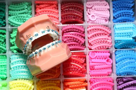 Who's Eligible for NHS Braces? | IOTN | Splash Orthodontics