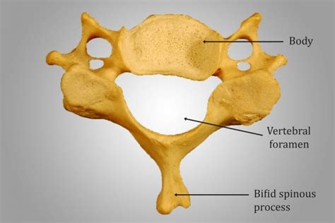 Vertebrae Different Types: Cervical, Thoracic, Lumbar, Sacrococcygeal