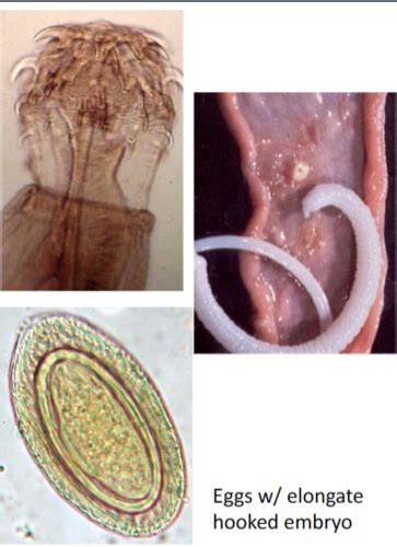 33-Acanthocephala Parasites Flashcards | Quizlet