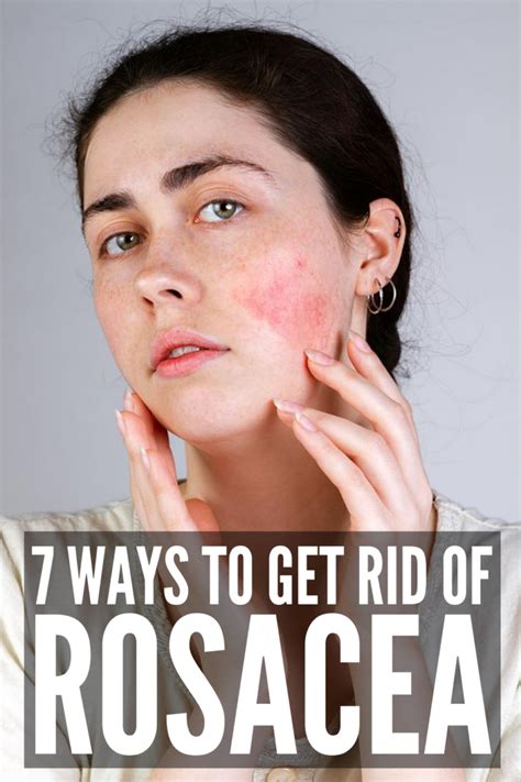 How to Get Rid of Rosacea: 7 Rosacea Remedies That Work