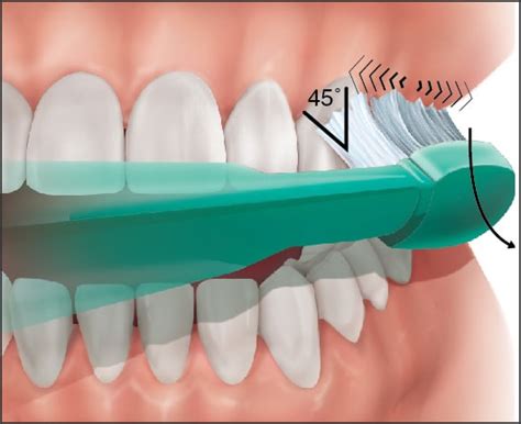 Teeth brushing: Techniques and recommended practices for proper teeth ...