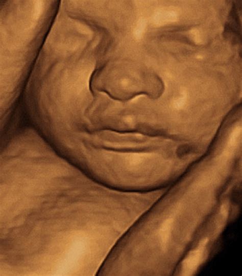 3d 30 Week Ultrasound: What To Expect? - Crying Toddlers