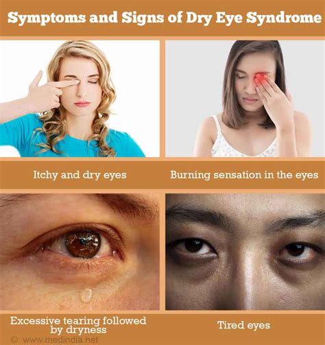 Dry Eye Syndrome Causes Symptoms Of Chronic Dry Eye