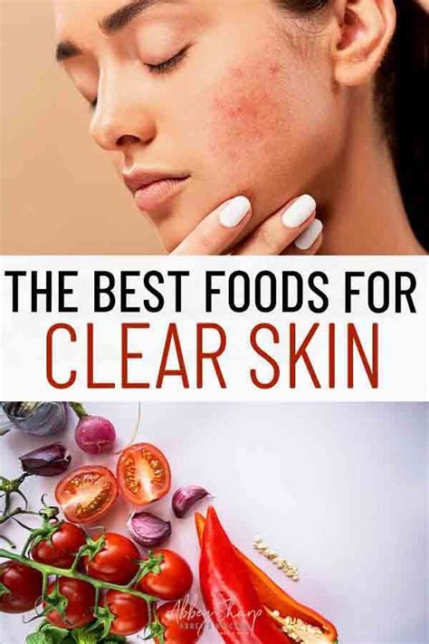 The Hormonal Acne Diet - The Best Foods for Healthy Clear Skin in 2021 ...