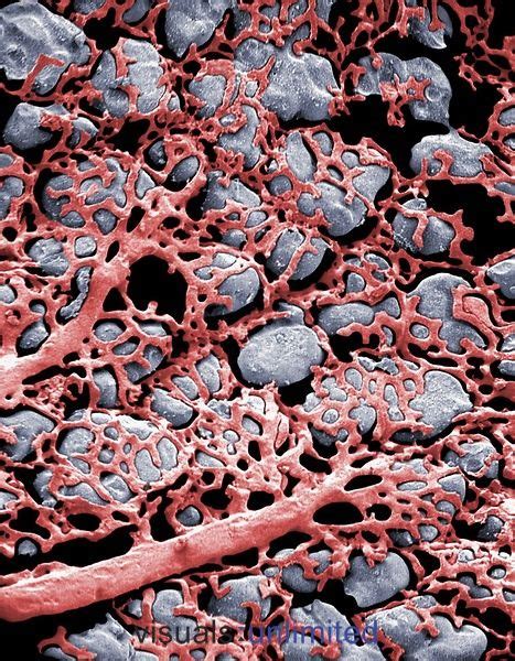 Capillaries and alveoli in the lung | Microscopic photography ...