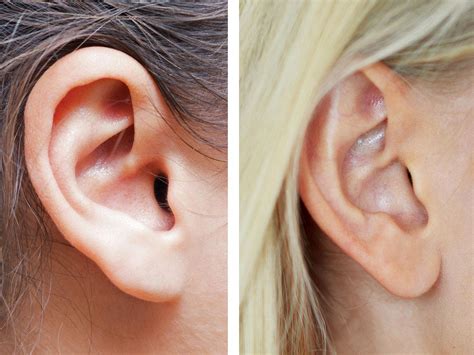 Attached and Detached Earlobes: The Curious Genetics Behind Your Ears