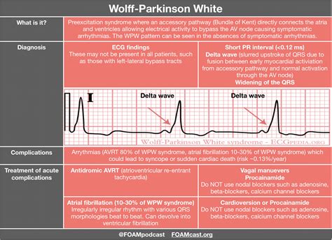 What Is The Treatment Of Ventricular Fibrillation