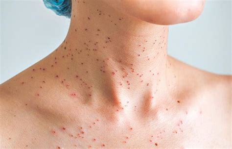 17 Common Causes of Red Dots on Skin