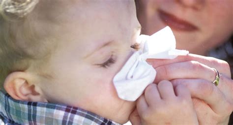 How to handle nosebleeds in children | BabyCenter