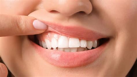 What Color Are Healthy Gums? - Valley Dental Care of Plainfield